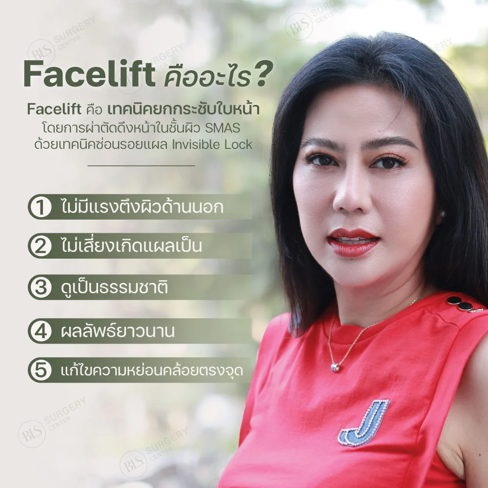 Facelift คืออะไร?