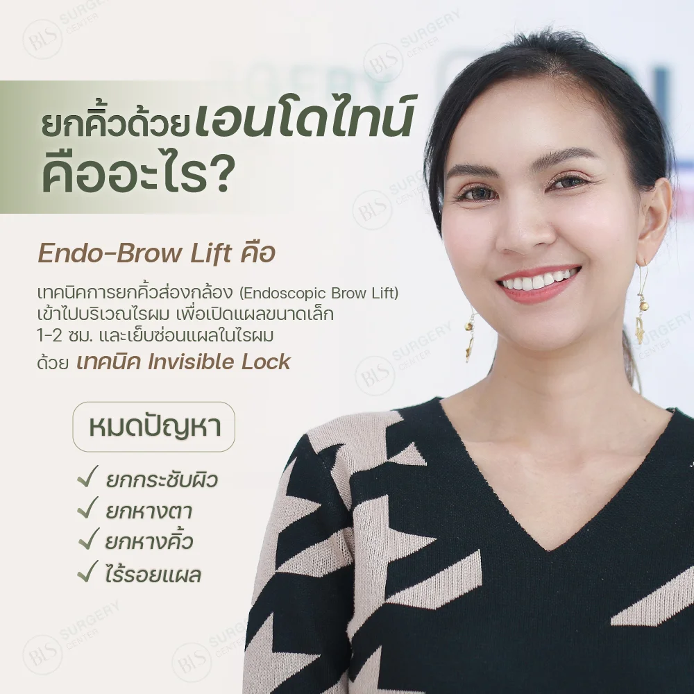 ยกคิ้วด้วยเอนโดไทน์ คืออะไร?