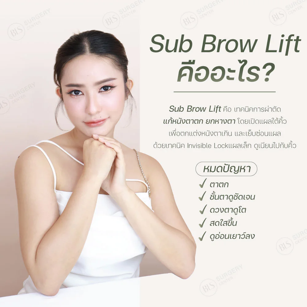 Sub Brow Lift คืออะไร? | แก้หนังตาตก (Subbrow Lift)