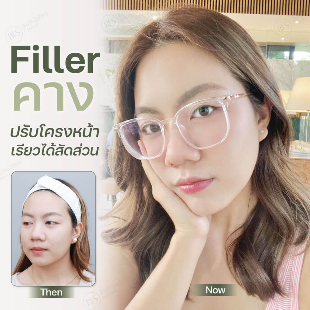 Filler ฟิลเลอร์ คาง | ฉีดฟิลเลอร์