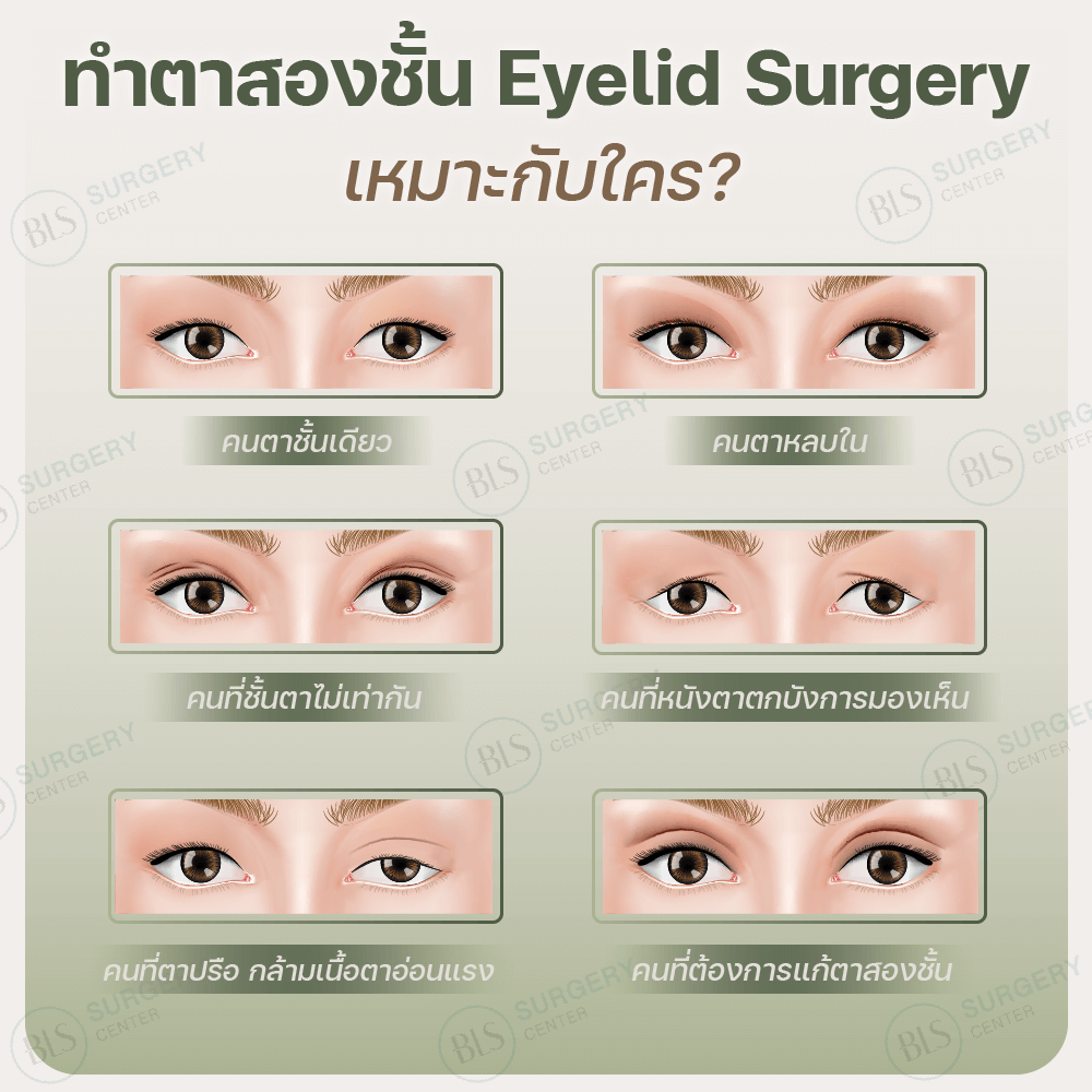 ทำตาสองชั้น เหมาะกับใคร?