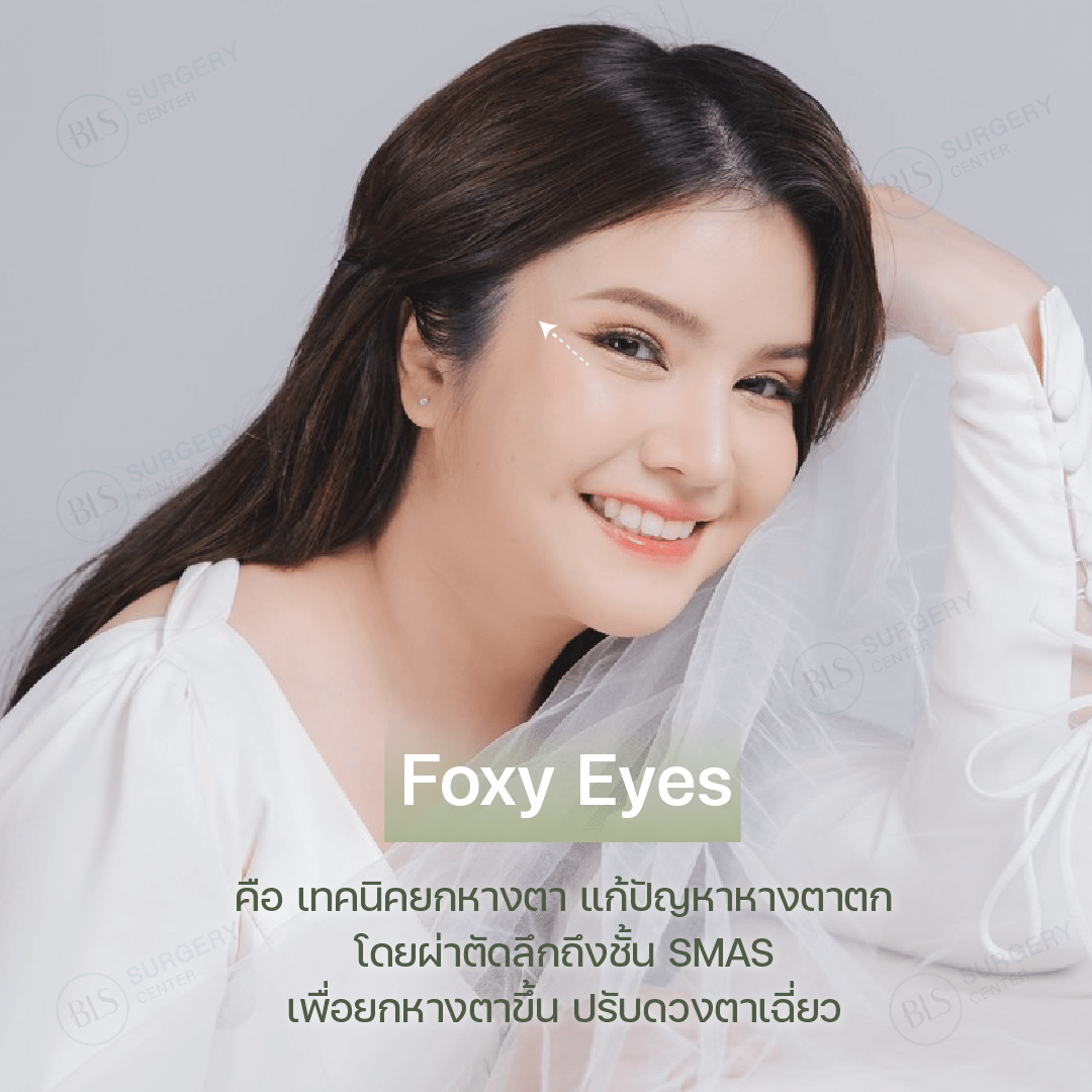 การทำ Foxy Eyes คืออะไร?