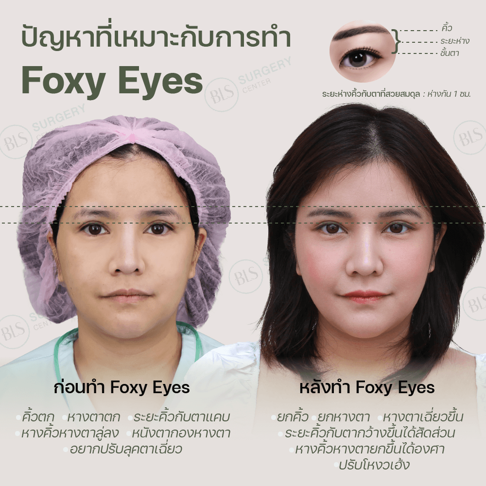 ปัญหาที่เหมาะกับการทำ Foxy Eyes