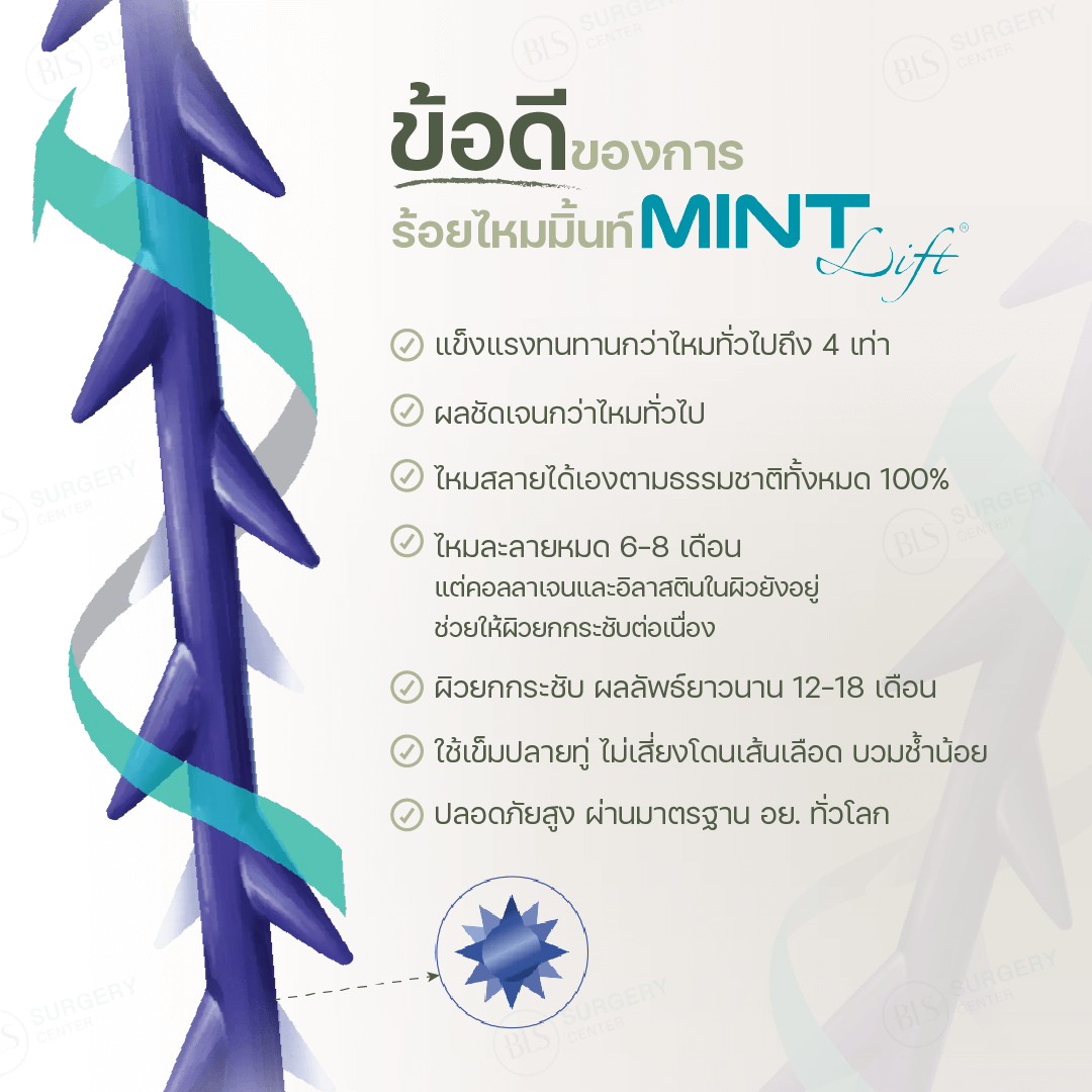 ข้อดีของการร้อยไหมมิ้นท์ (Mint Lift)