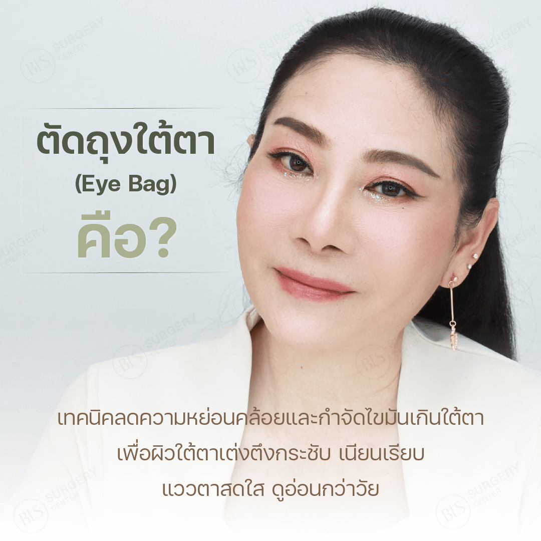 ศัลยกรรมถุงใต้ตา (Eye Bag) คืออะไร?