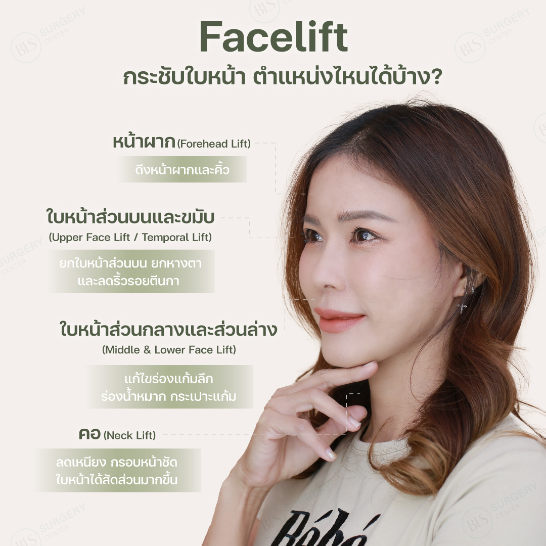 Facelift กระชับใบหน้า ตำแหน่งไหนได้บ้าง?​