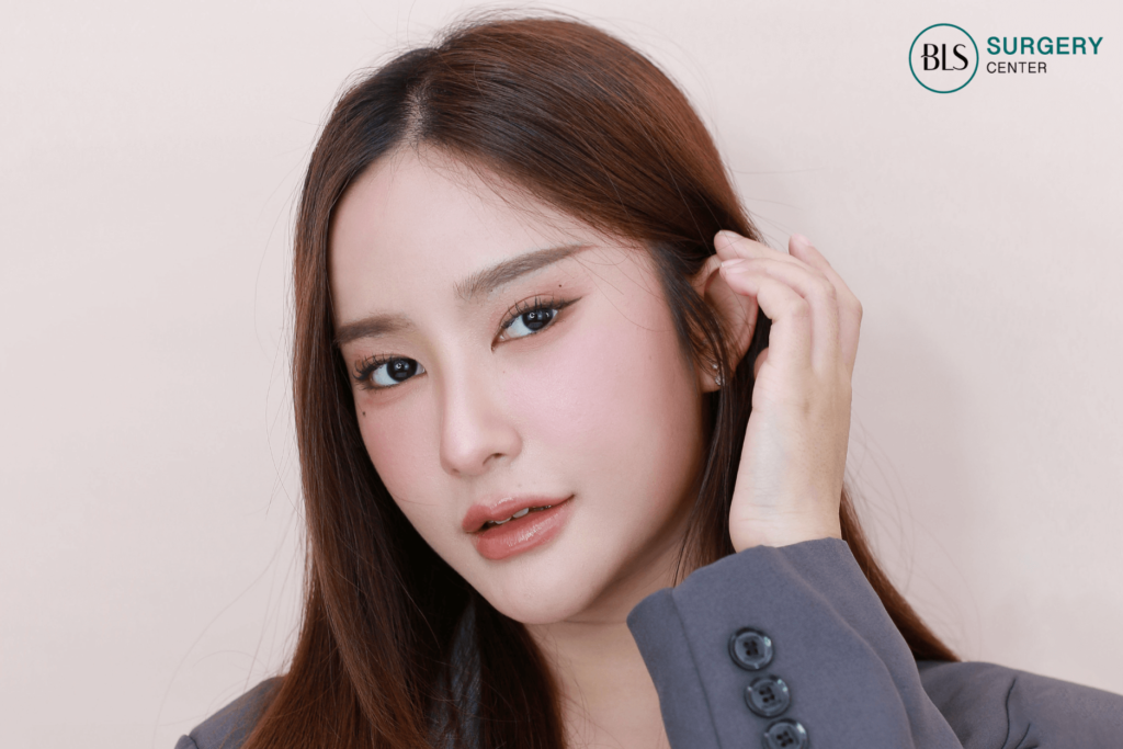 ผลลัพท์หลัง ทำ  Foxy Eyes & Subbrow Lift  14 วัน