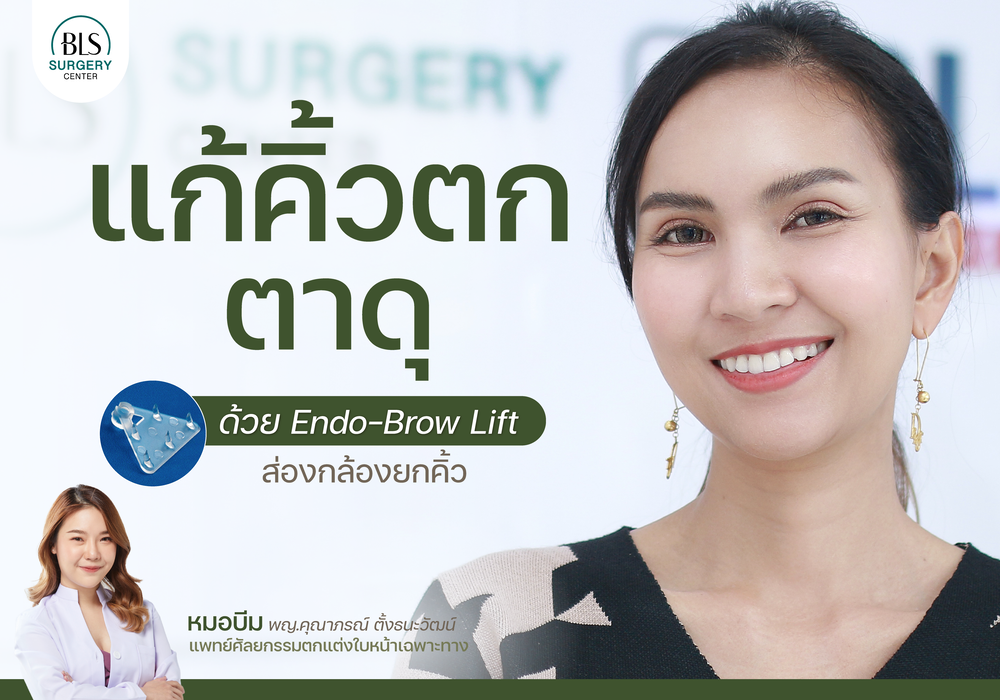 แก้ปัญหาคิ้วตก ตาดุ ด้วย Endo-Brow Lift ส่องกล้องยกคิ้ว