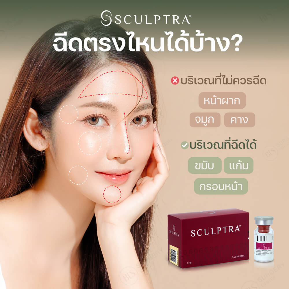 Sculptra ฉีดตรงไหนได้บ้าง?