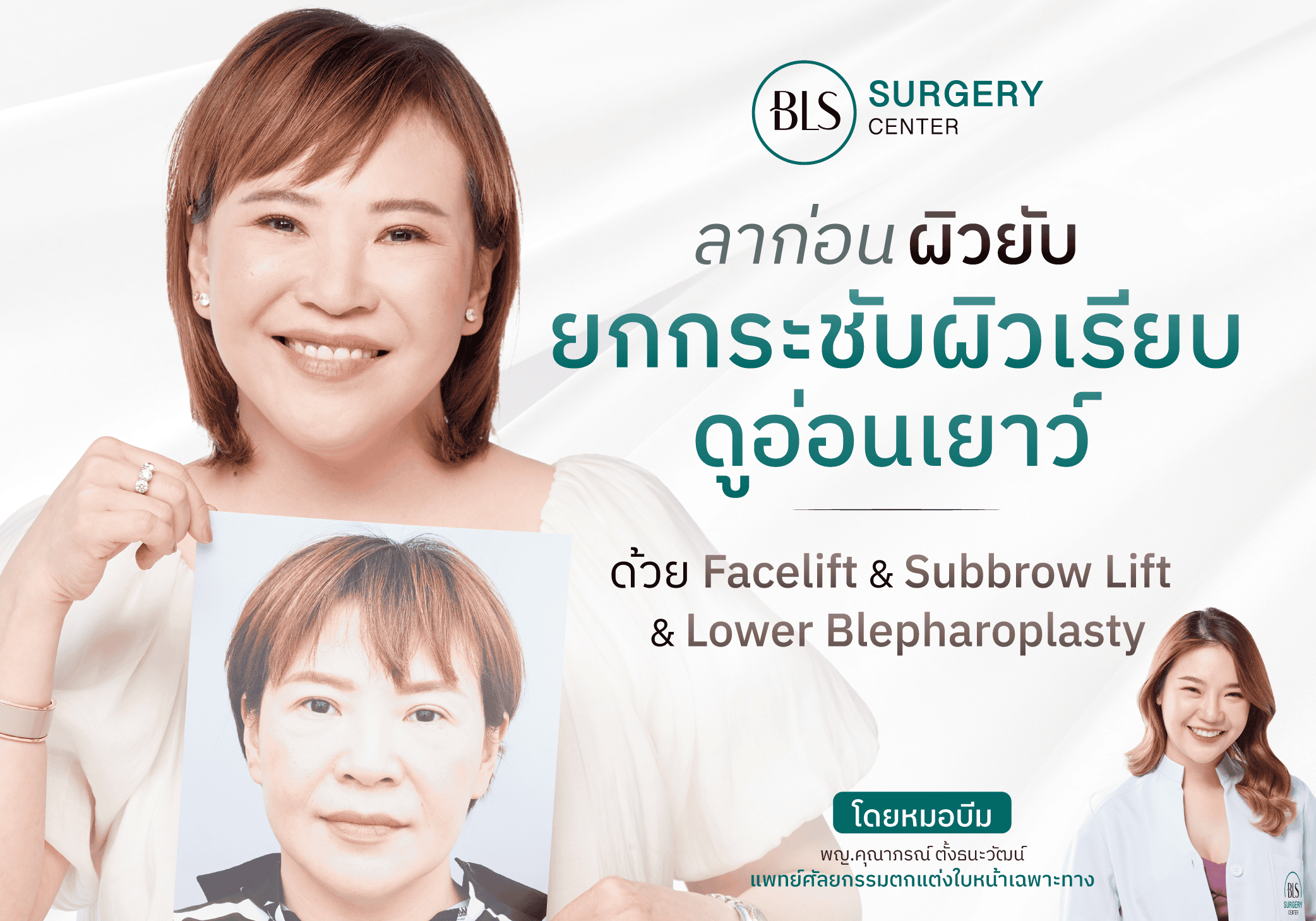 ลาผิวยับ ยกกระชับผิวเรียบ ด้วย Facelift Subbrow Lift และศัลยกรรมถุงใต้ตา