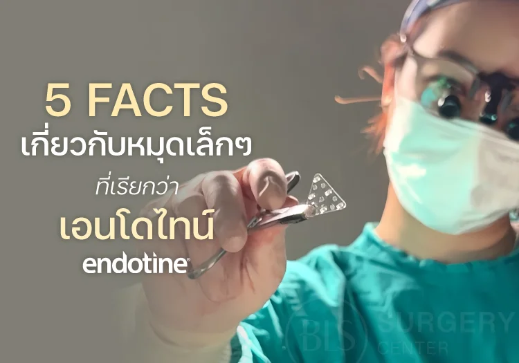 5 Facts เกี่ยวกับหมุดเล็กๆ ที่เรียกว่า เอนโดไทน์ (Endotine)