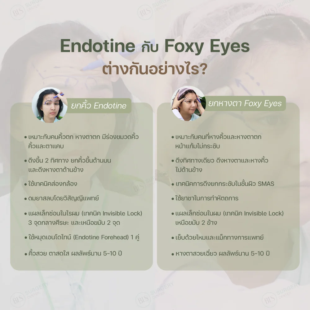 Endotine กับ Foxy Eyes ต่างกันยังไง