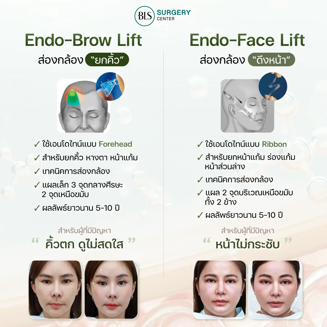 Endo face lift ต่างจาก Endo-Brow Lift อย่างไร?