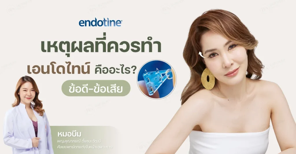 เหตุผลที่ควรทำเอนโดไทน์ คืออะไร? ข้อดี-ข้อเสีย มีอะไรบ้าง?