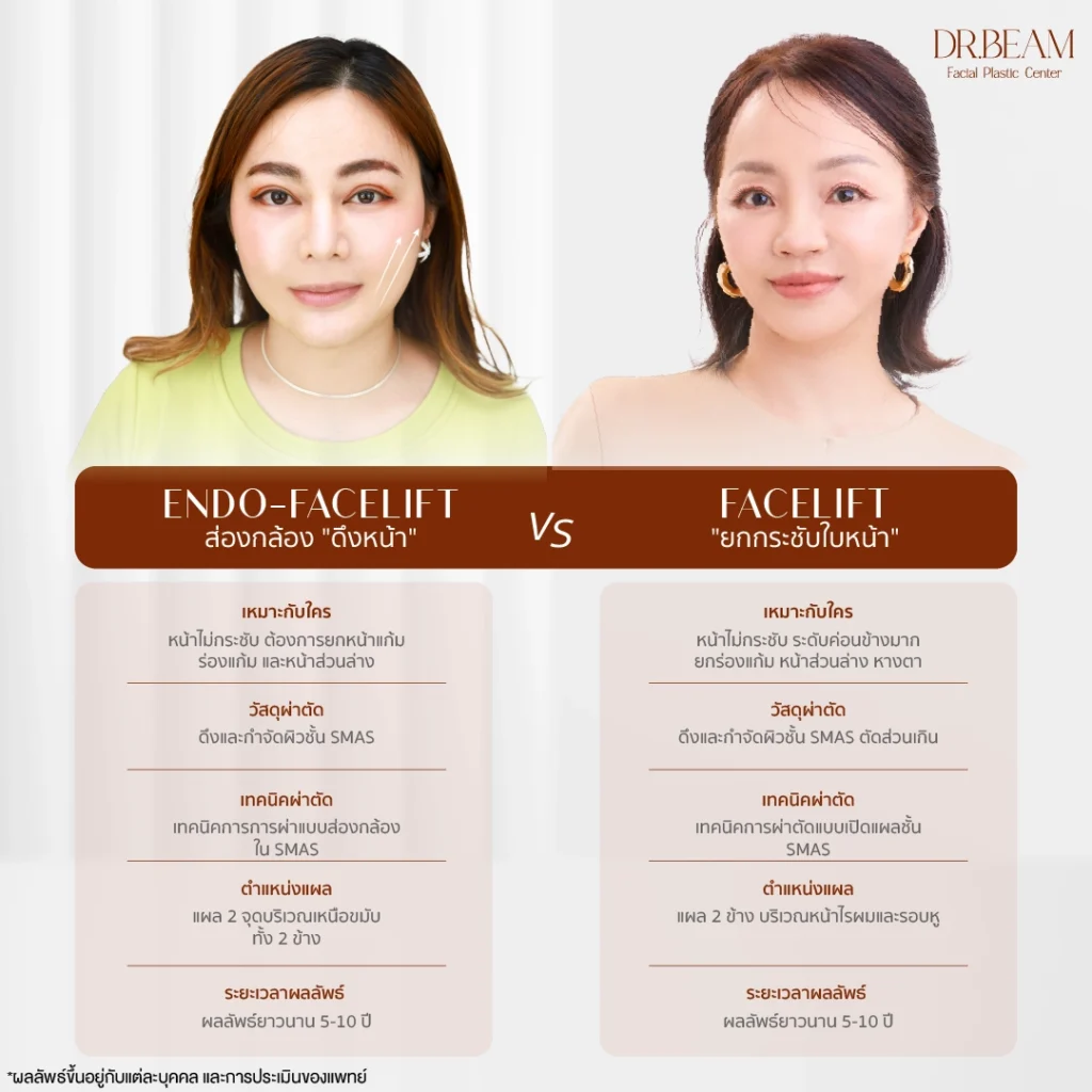 Endo-Facelift ต่างจาก Facelift อย่างไร