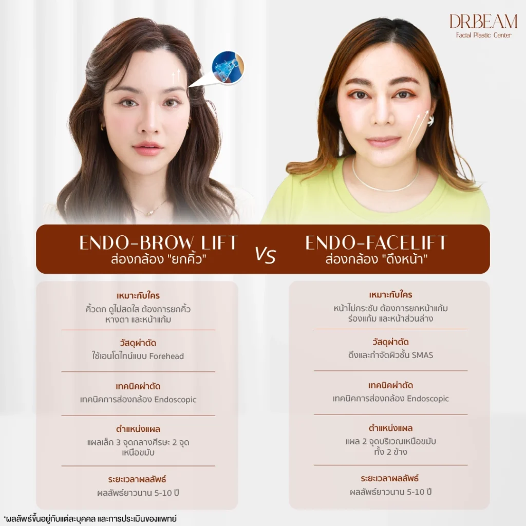 Endo facelift ต่างจาก Endo-Browlift อย่างไร