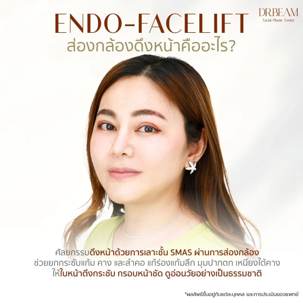 Endo faceliftคืออะไร