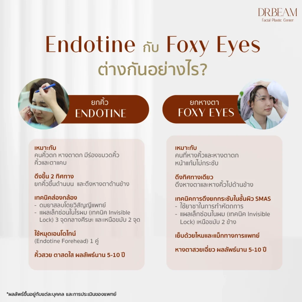 Endotine กับ Foxy Eyes ต่างกันยังไง
