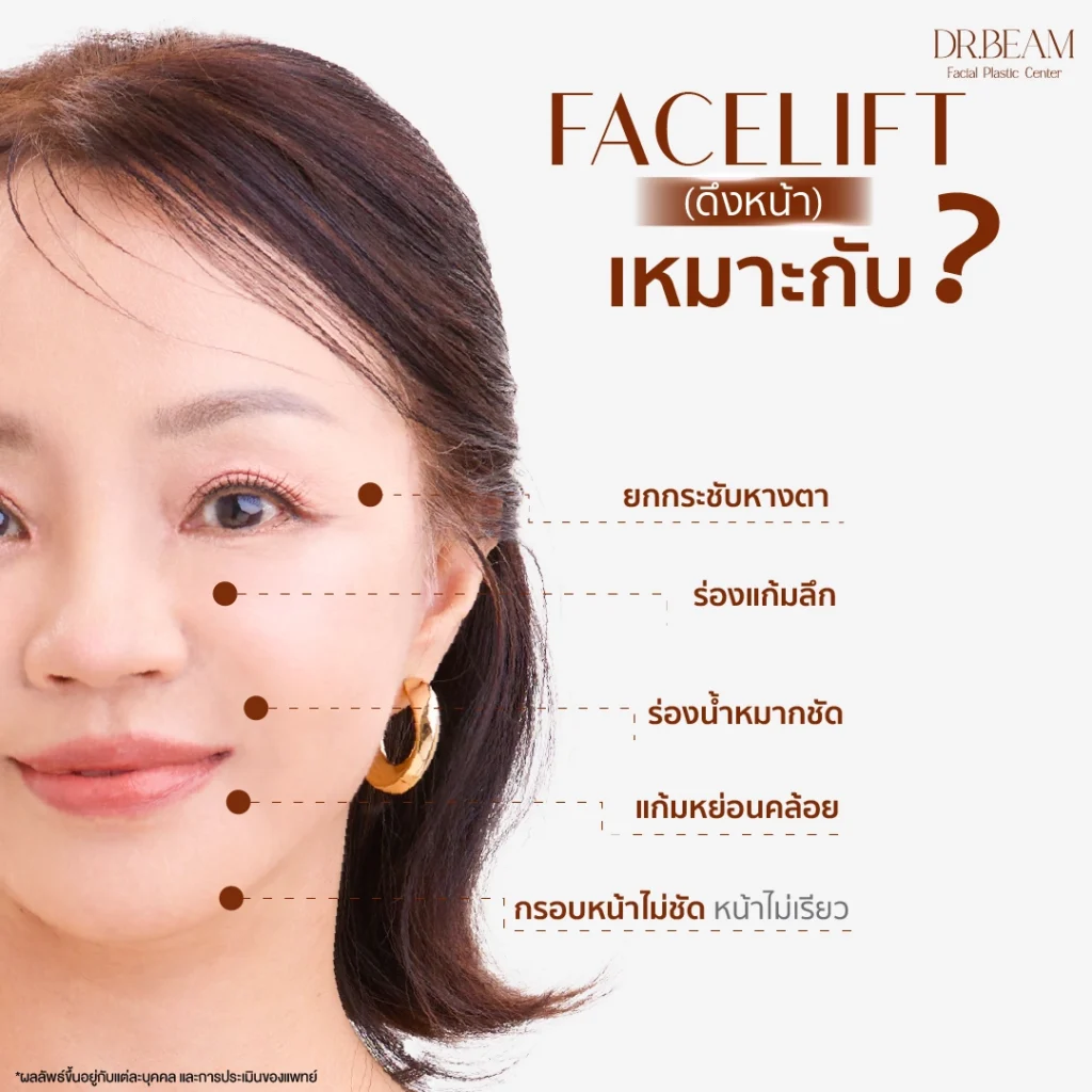 Facelift ดึงหน้าเหมาะกับใคร