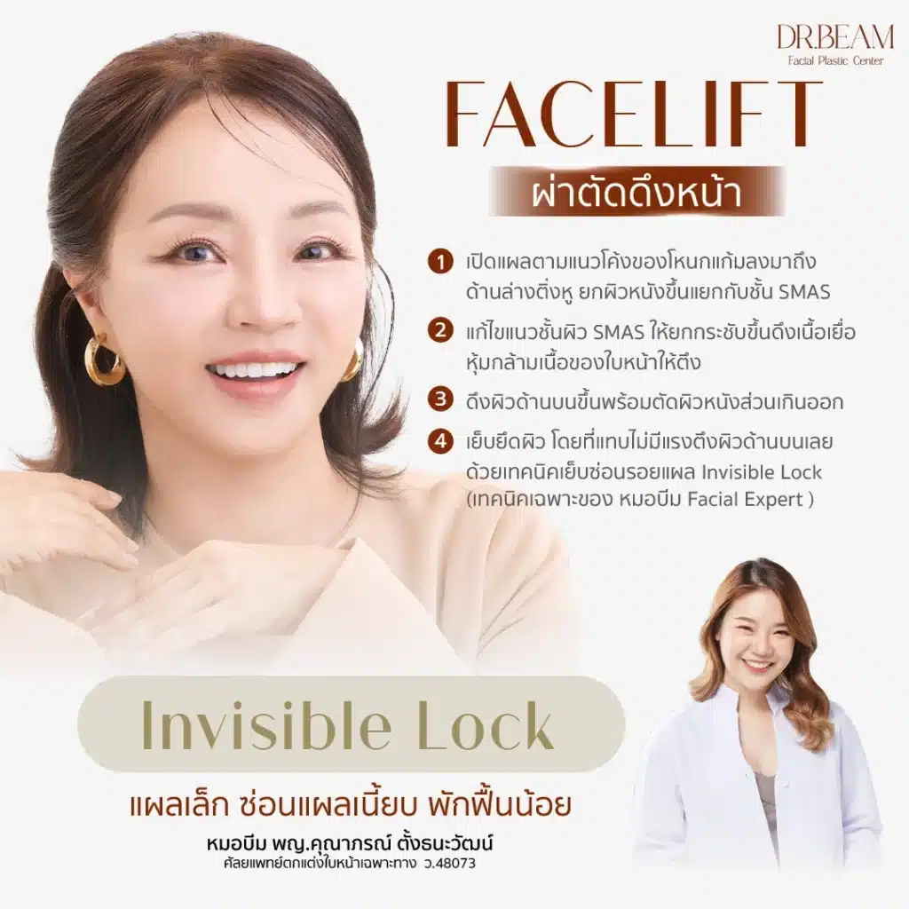 Facelift ผ่าตัดดึงหน้า_Invisible Lockแผลเล็กซ่อน แผลเนี้ยบ พักฟื้นน้อย