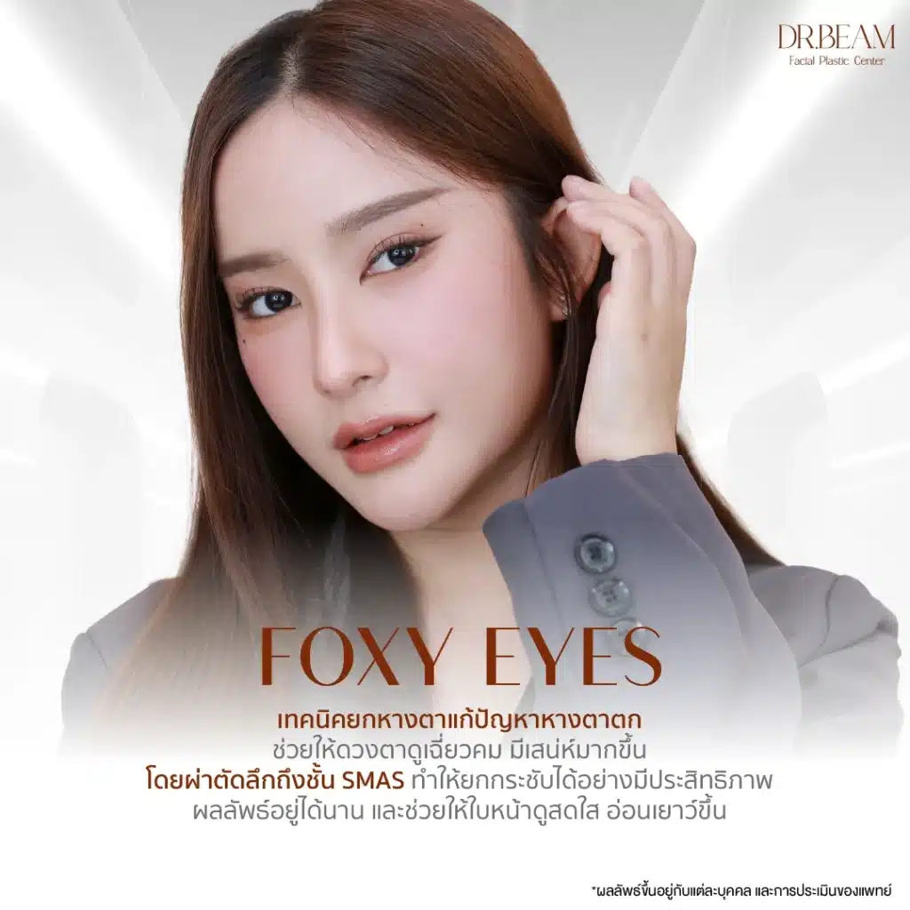 Foxy Eyes คืออะไร?