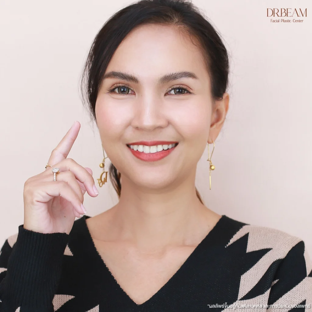 การทำผ่าตัดยกคิ้วส่องกล้อง Endobrow Lift เป็นหัตถการที่แก้ปัญหาได้ตรงจุด
