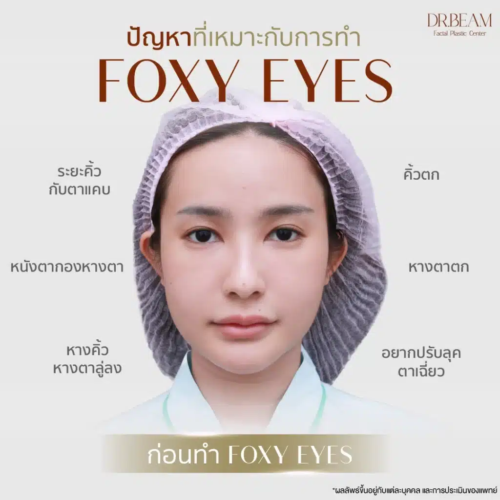 ก่อนทำ - ปัญหาที่เหมาะกับการทำ Foxy Eyes 