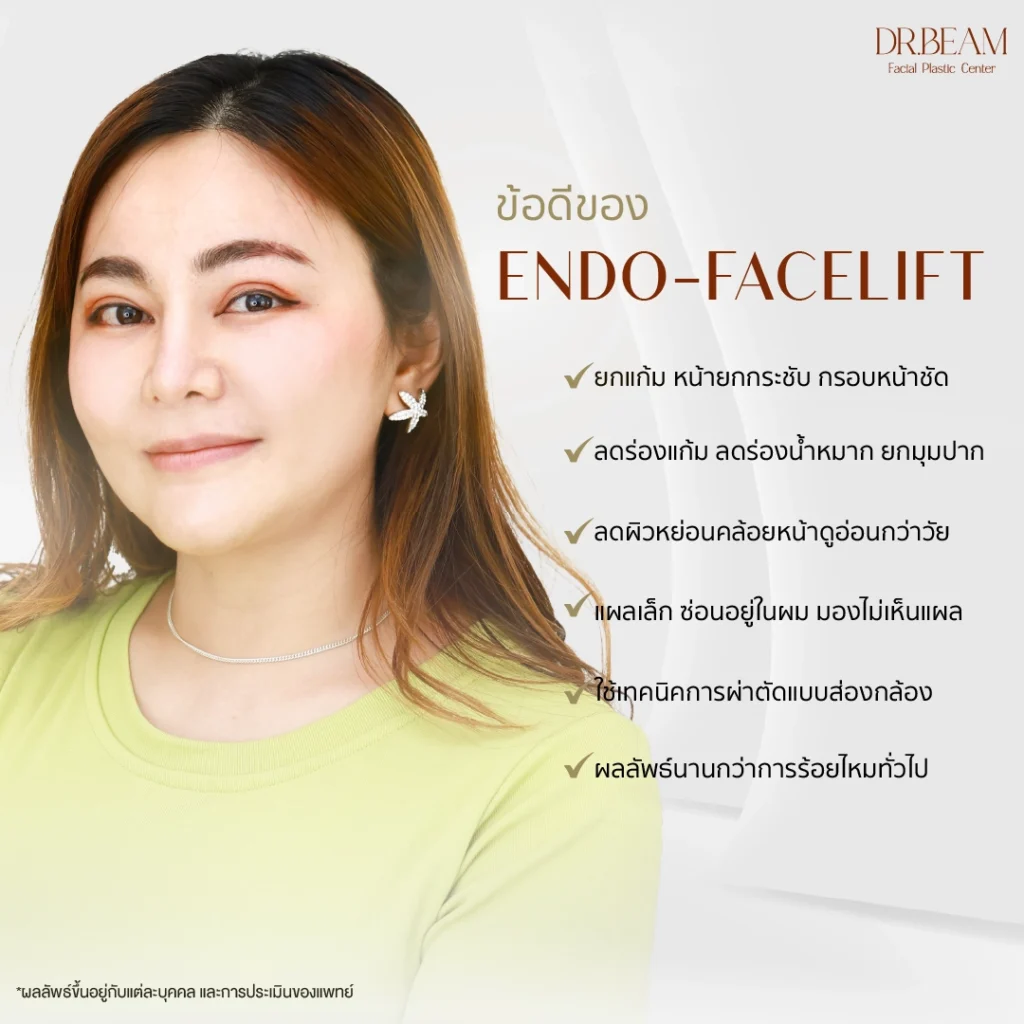 ข้อดีของการทำ-Endo-facelift
