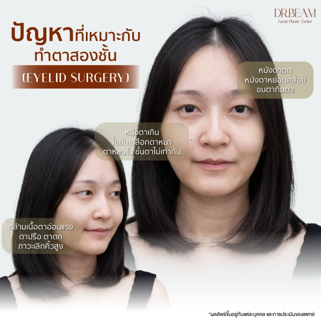 ปัญหาที่เหมาะกับการทำตาสองชั้น