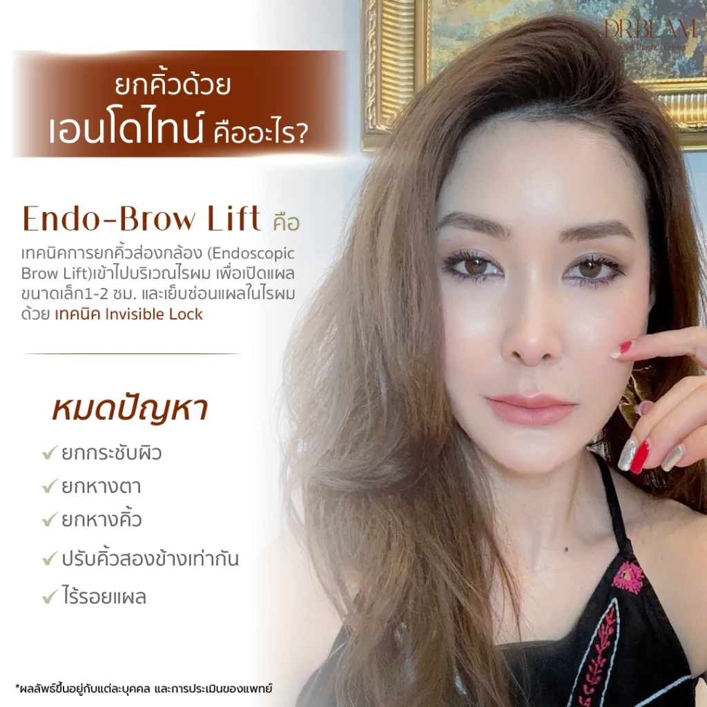 ยกคิ้วเอนโดไทน์