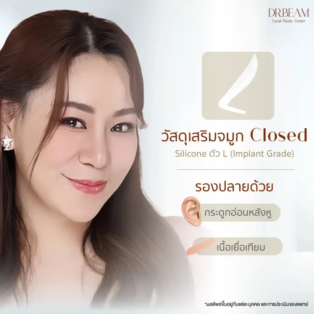 การ เสริมจมูก (Rhinoplasty) เทคนิค Closed คืออะไร? หมอบีม Facial Expert มีคำตอบ