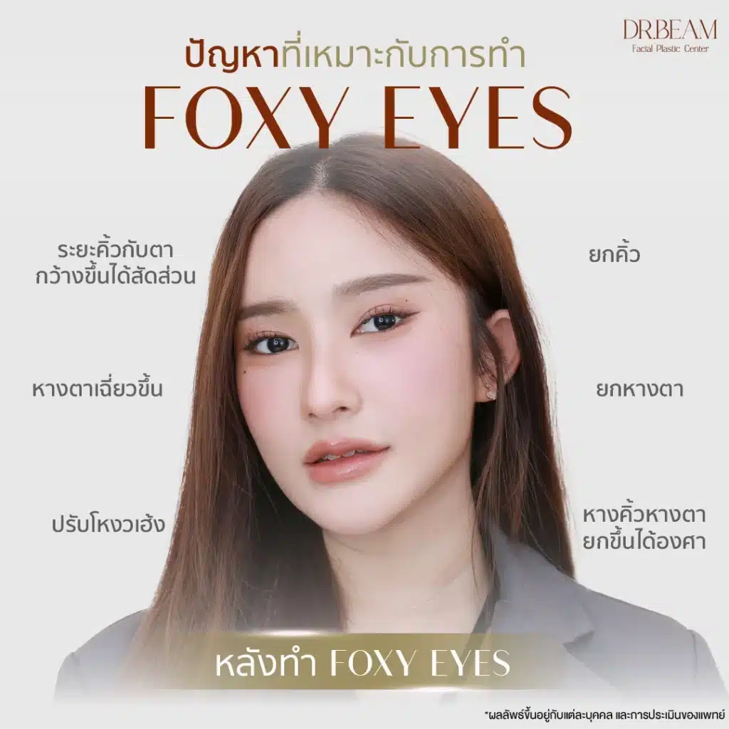 หลังทำ - ปัญหาที่เหมาะกับการทำ Foxy Eyes 