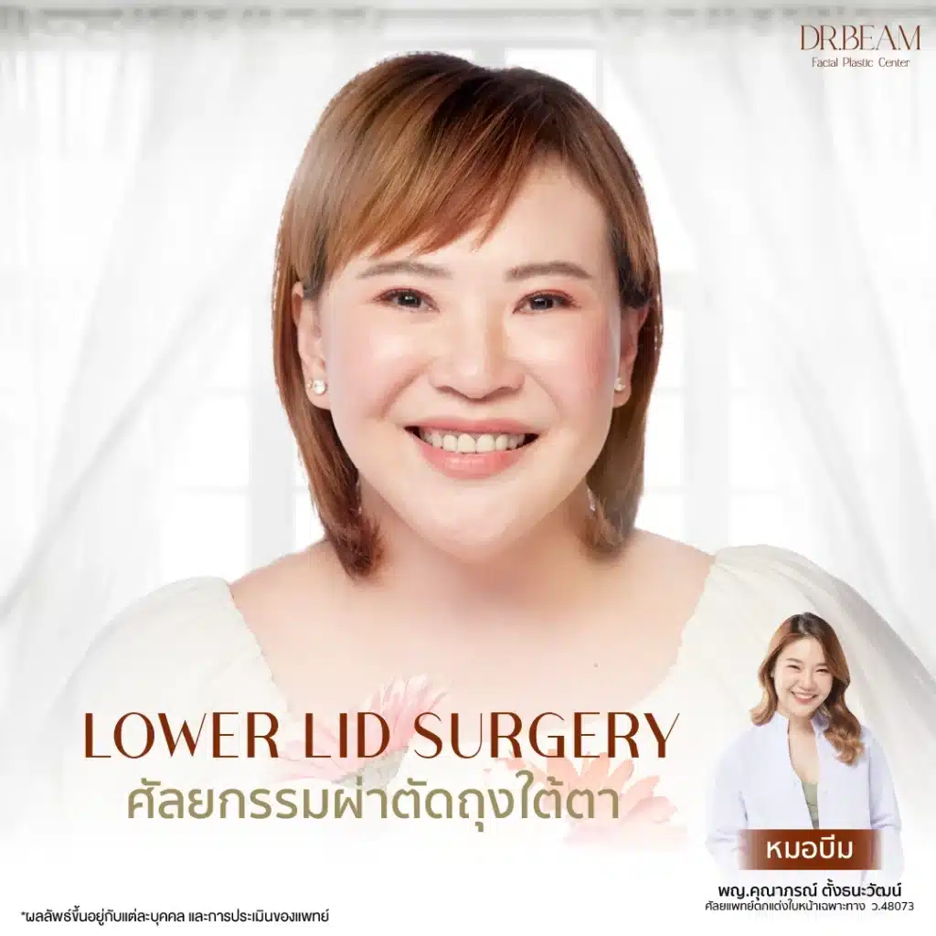 ผ่าตัดถุงใต้ตา พร้อมกับการทำตาสองชั้น (Eyelid Surgery) หรือการผ่าตัดดึงหน้า (Facelift)