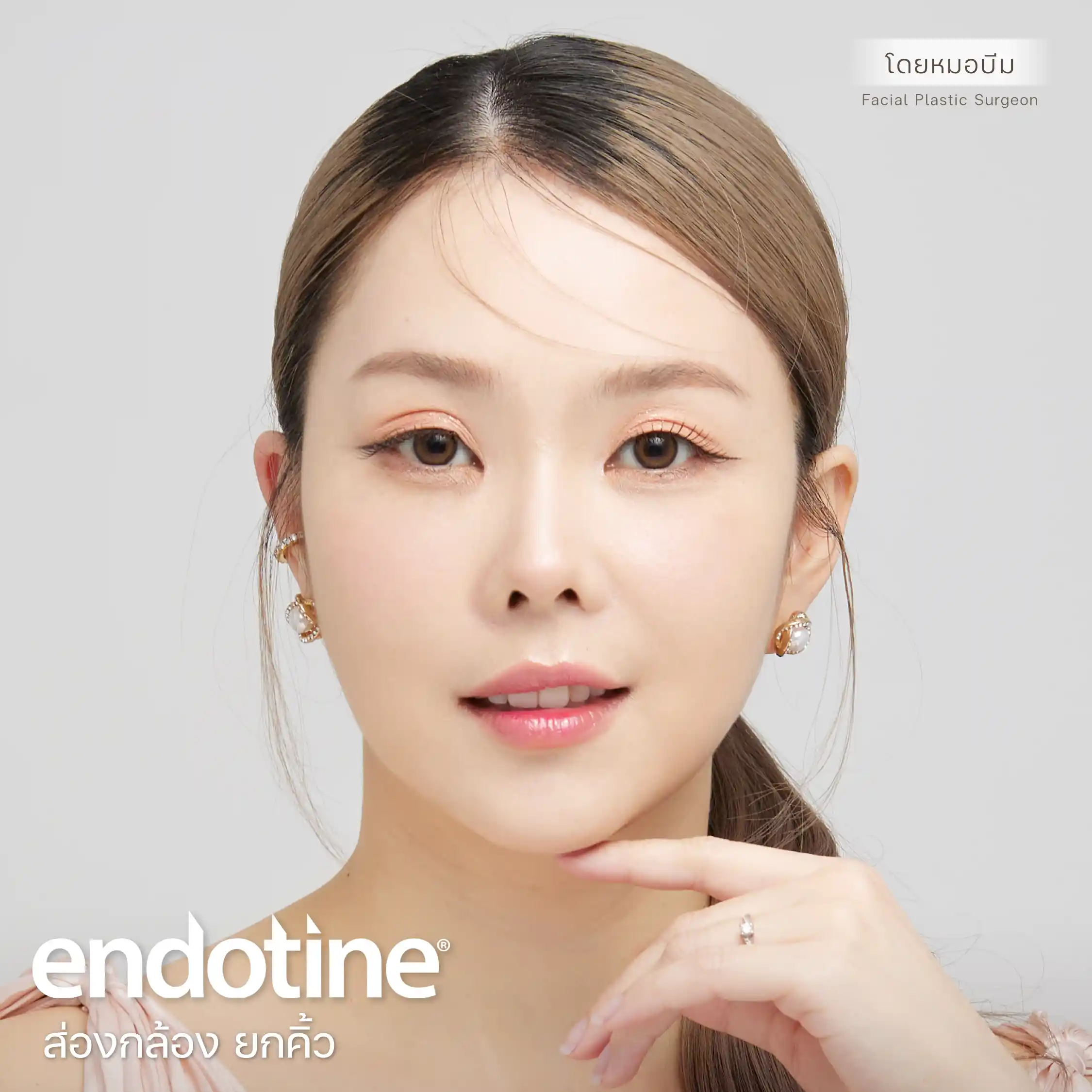 Endotine ยกคิ้วส่องกล้อง