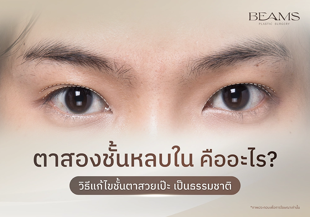 ตาสองชั้นหลบใน