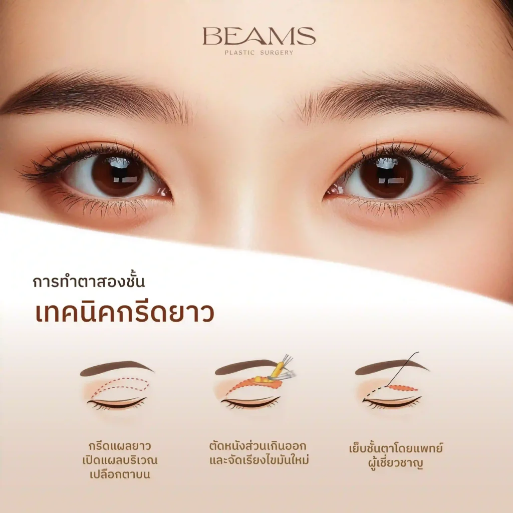 ทำตาสองชั้นแบบกรีดยาว