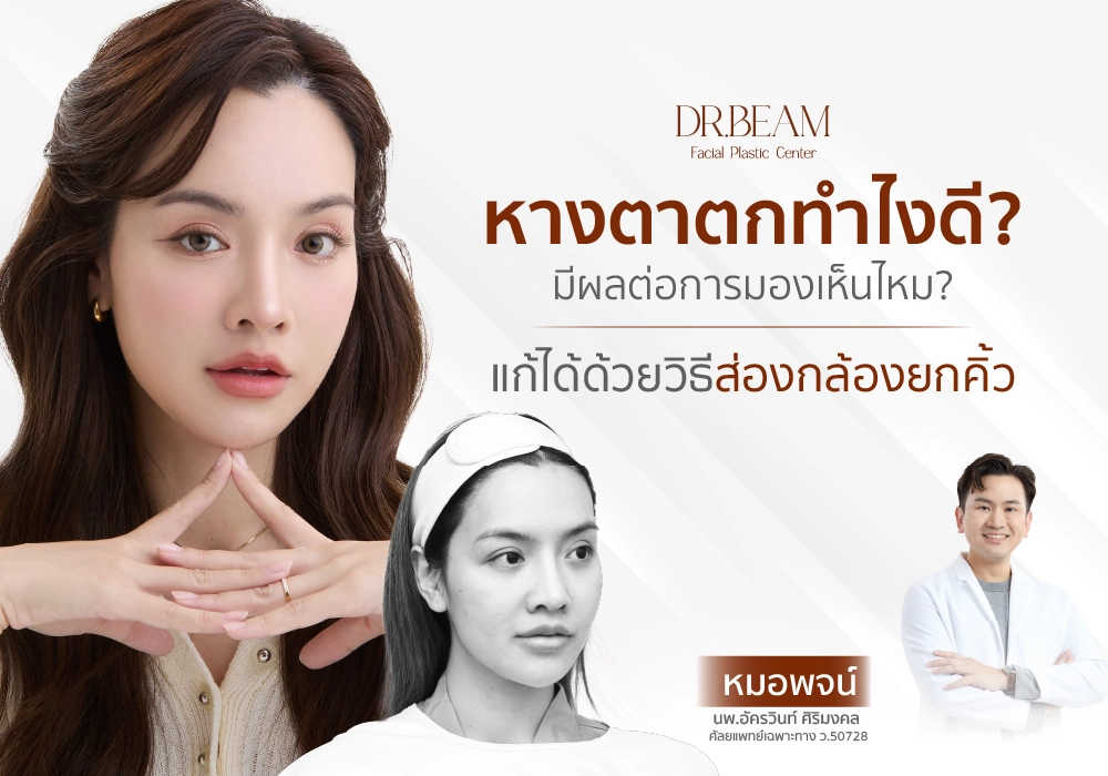 หางตาตกทำไงดี มีผลต่อการมองเห็นไหม แก้ด้วยวิธีส่องกล้องยกคิ้ว