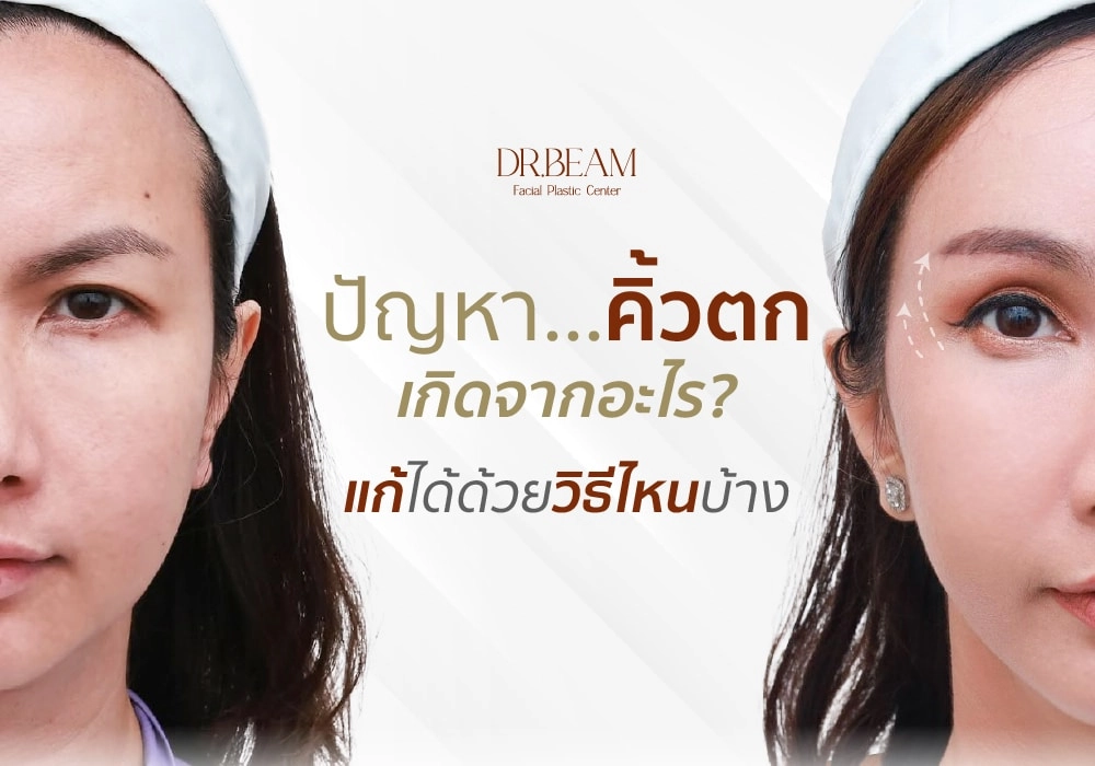 ปัญหาคิ้วตกเกิดจากอะไร แก้ได้ด้วยวิธีไหนบ้าง