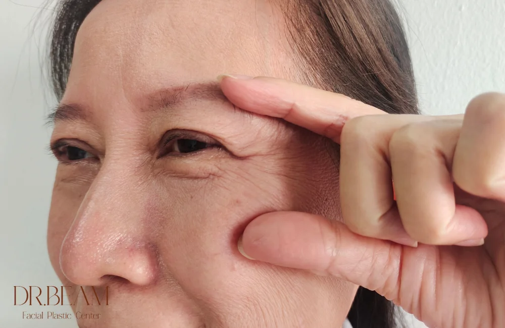 วิธีแก้ปัญหาหนังตาและใต้ตาเหี่ยว