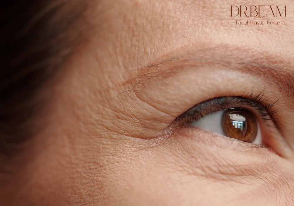 ตีนกาเกิดจากอะไร