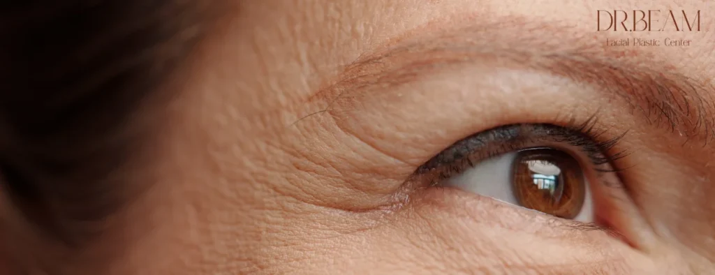 ตีนกาเกิดจากอะไร