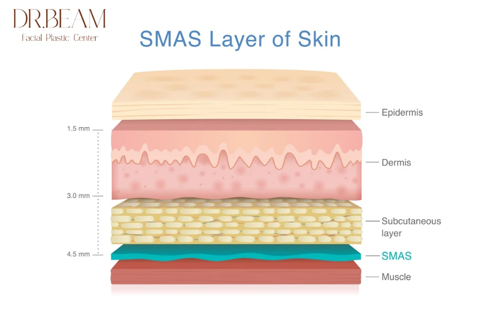 สร้างผิวชั้น SMAS คืออะไร