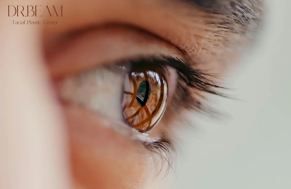 ดูแลหลังทำตาสองชั้นสายฝอ