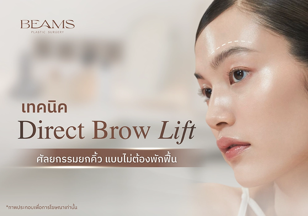 ยกคิ้ว direct brow lift