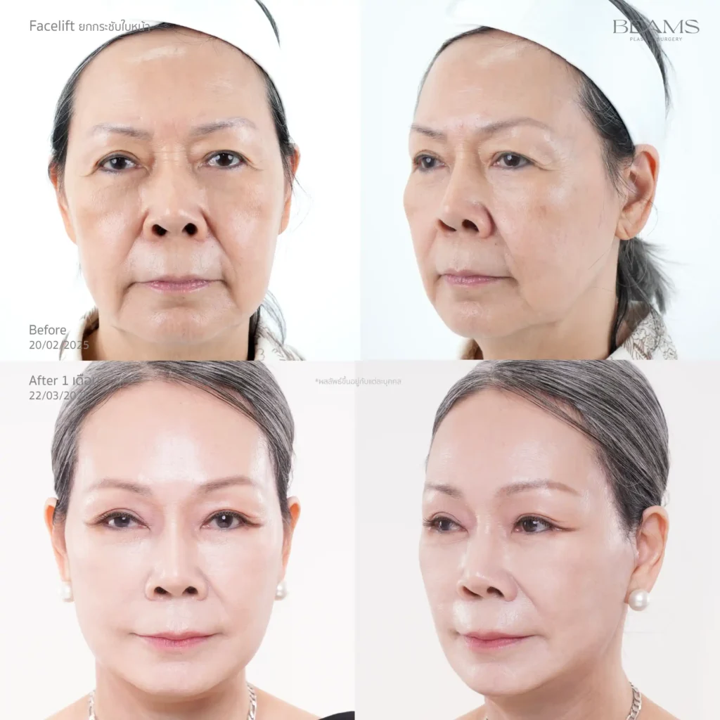 ดึงหน้ารีวิว