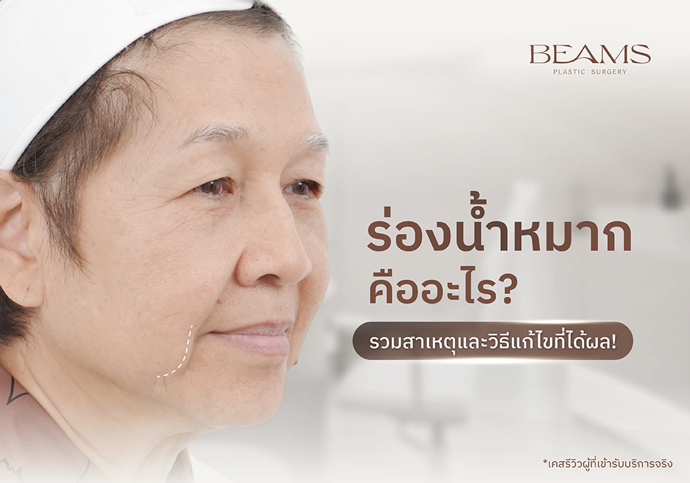 ร่องน้ำหมาก