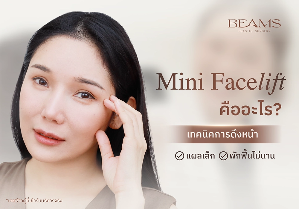 เทคนิค Mini Facelift