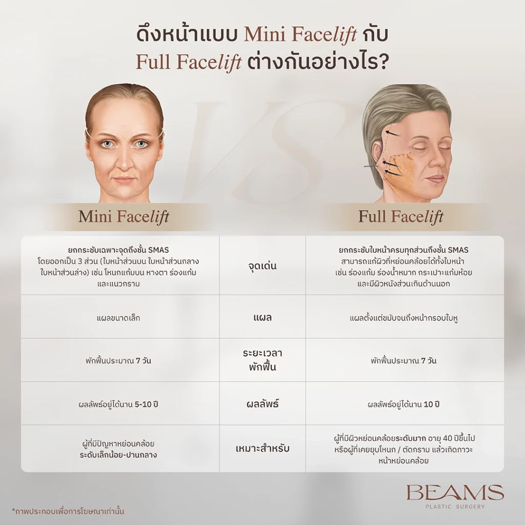 Mini Facelift vs Full Facelit