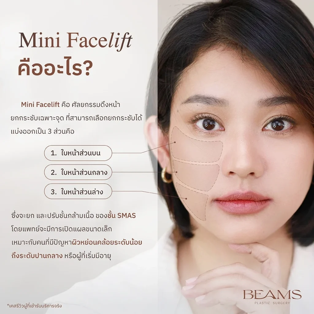 Mini Facelift คืออะไร