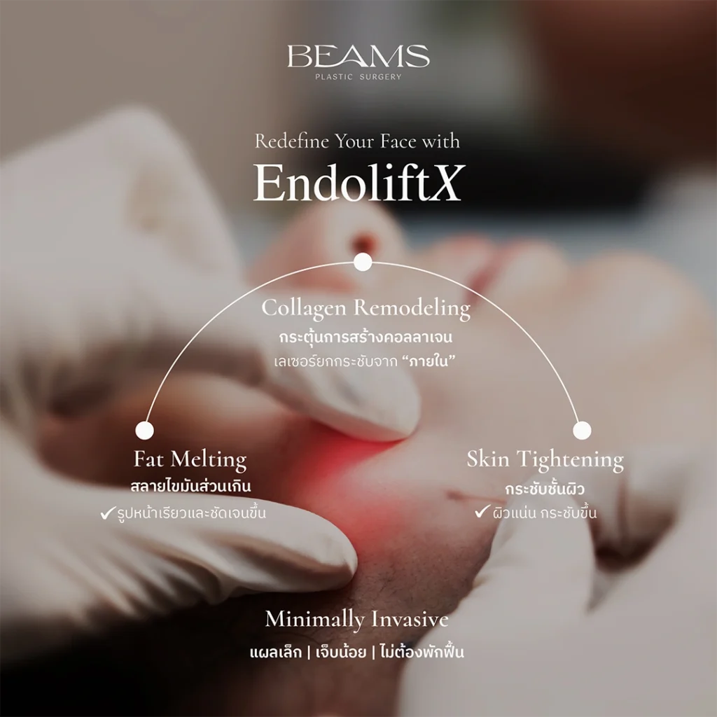 EndoliftX ช่วยอะไรบ้าง